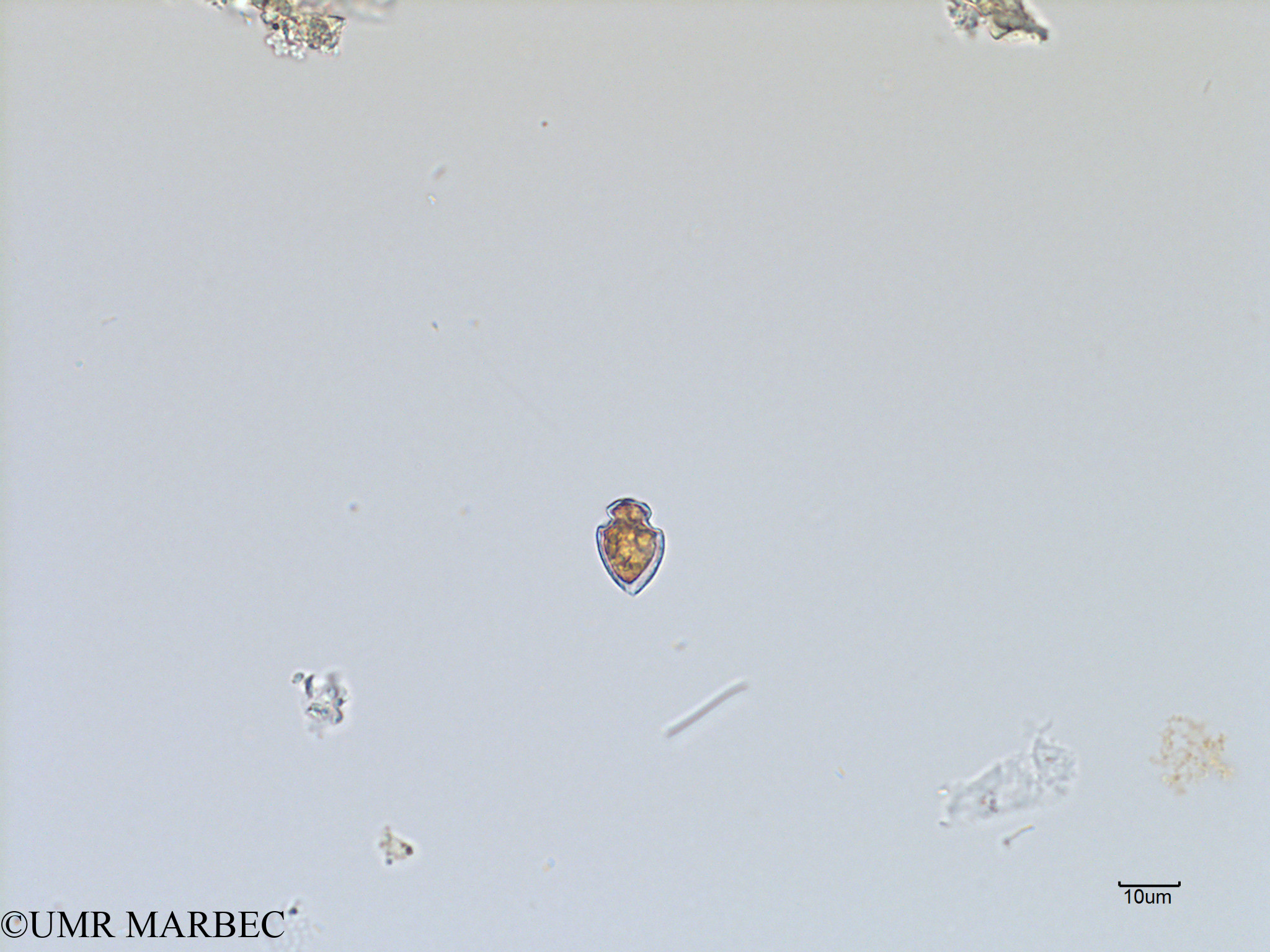 phyto/Scattered_Islands/iles_glorieuses/SIREME November 2015/Oxytoxum laticeps (SIREME-Glorieuses2015-ech8-241116-photo24 oxytoxum-2)(copy).jpg